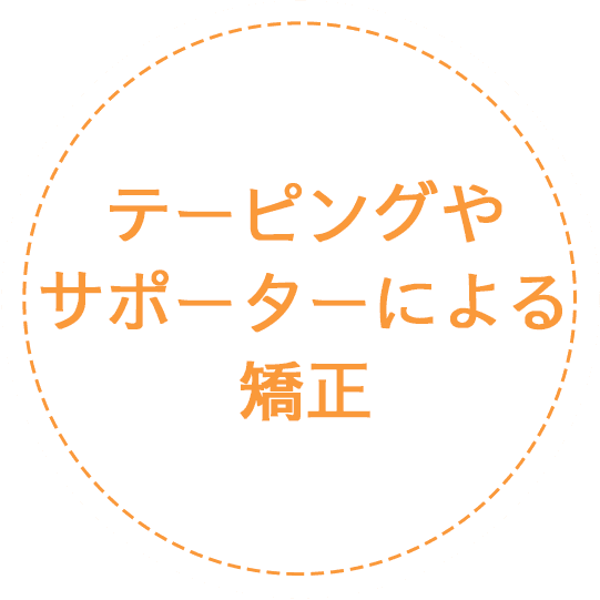 テーピングやサポーターによる矯正