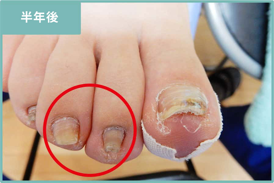 半年後