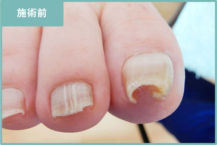 初回