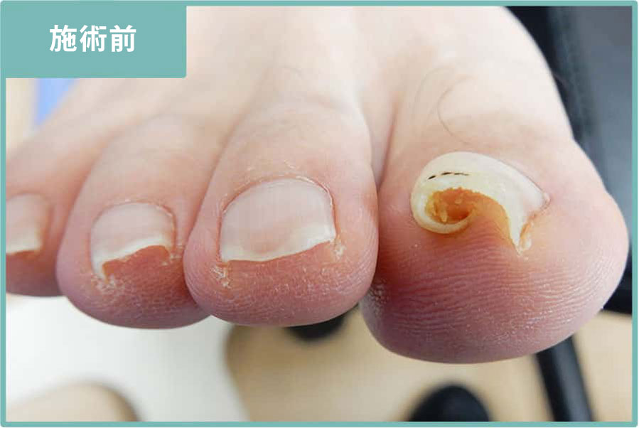 初回