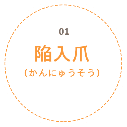 陥入爪