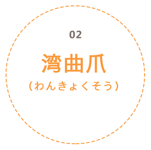 湾曲爪